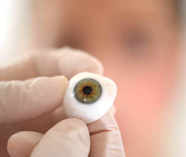 Applicazione Protesi Oculari - ETM CENTRO VISIONE